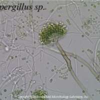  - Aspergillus oryzae